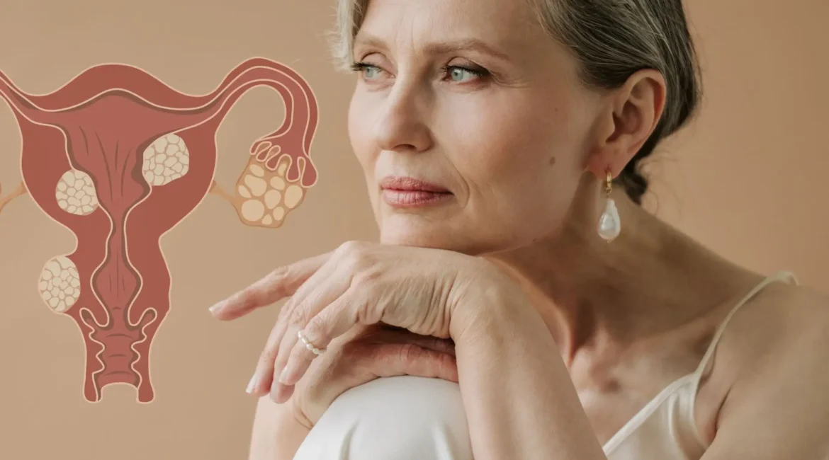 endometriose na menopausa