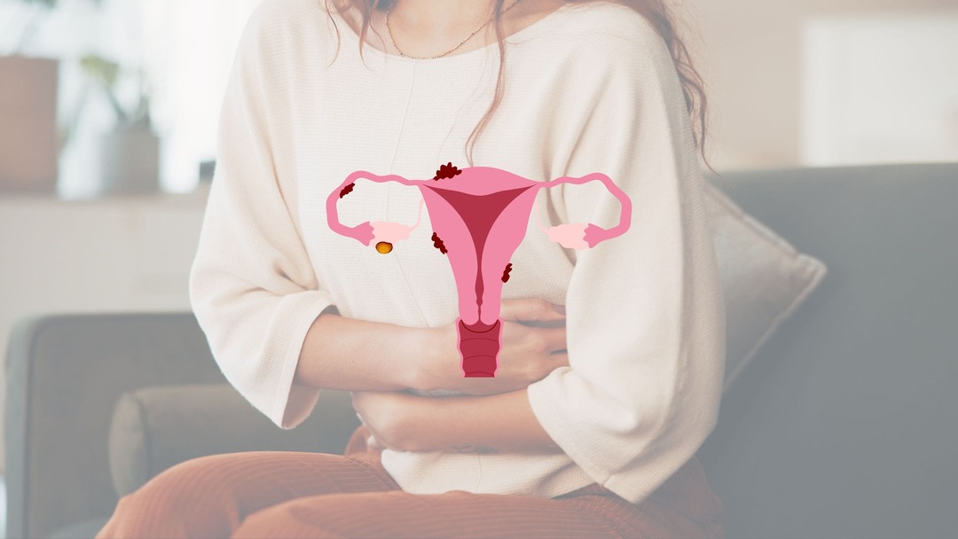 A importância de realizar os exames de endometriose com uma radiologista especializada (1)