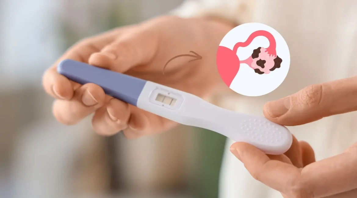 É possível engravidar com endometriose