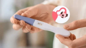 É possível engravidar com endometriose?