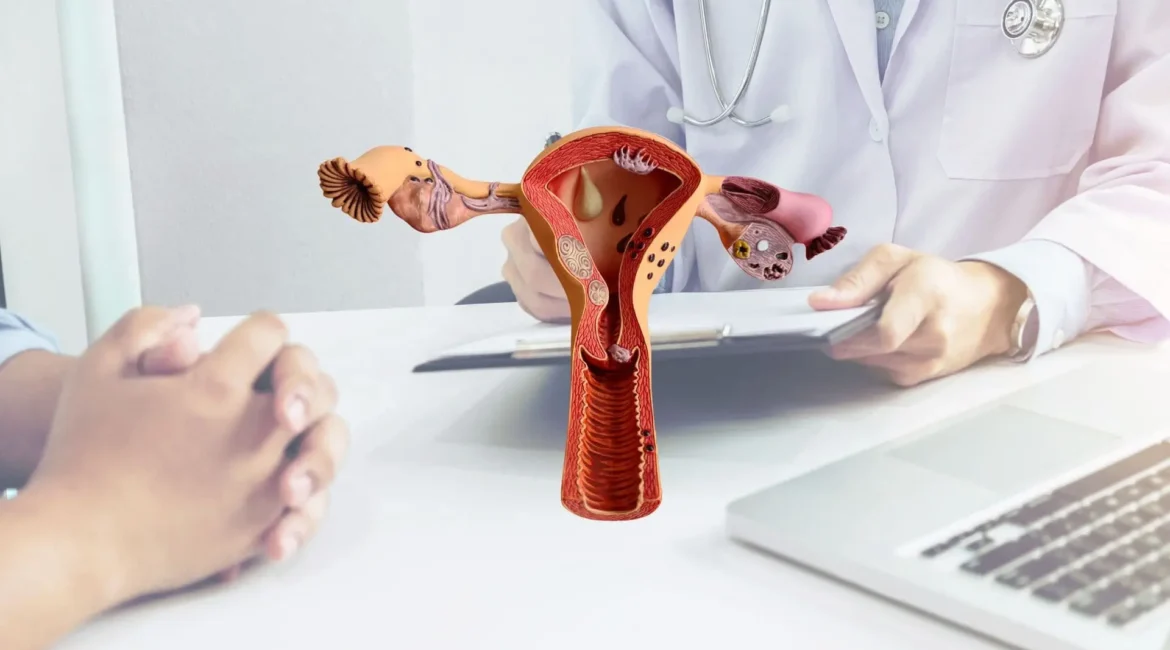 Tratamento Clinico da endometriose