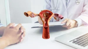 Tratamento clínico da endometriose